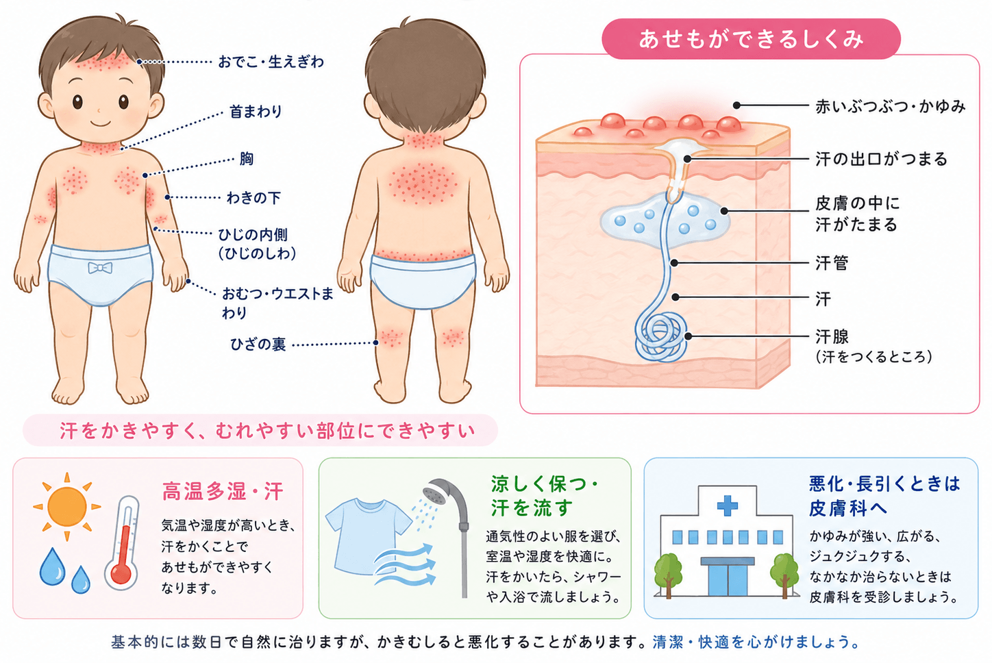汗疹（あせも）とは