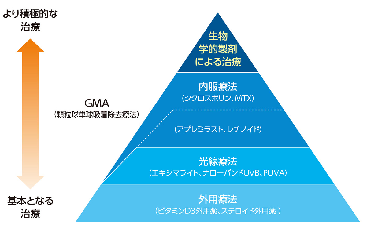 乾癬の治療 イメージ
