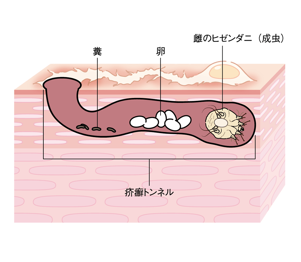 診断方法イメージ